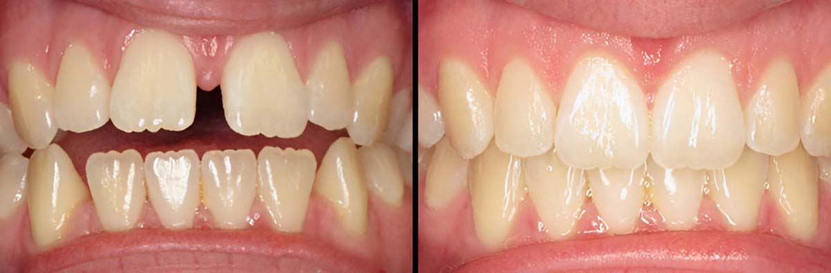 dental-image